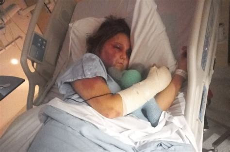 kira hart news|Teenage victim of savage Queensland beating speaks ...